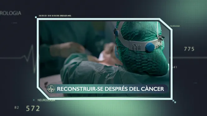 SUPERAR EL CÀNCER I RECONSTRUIR LA MAMA